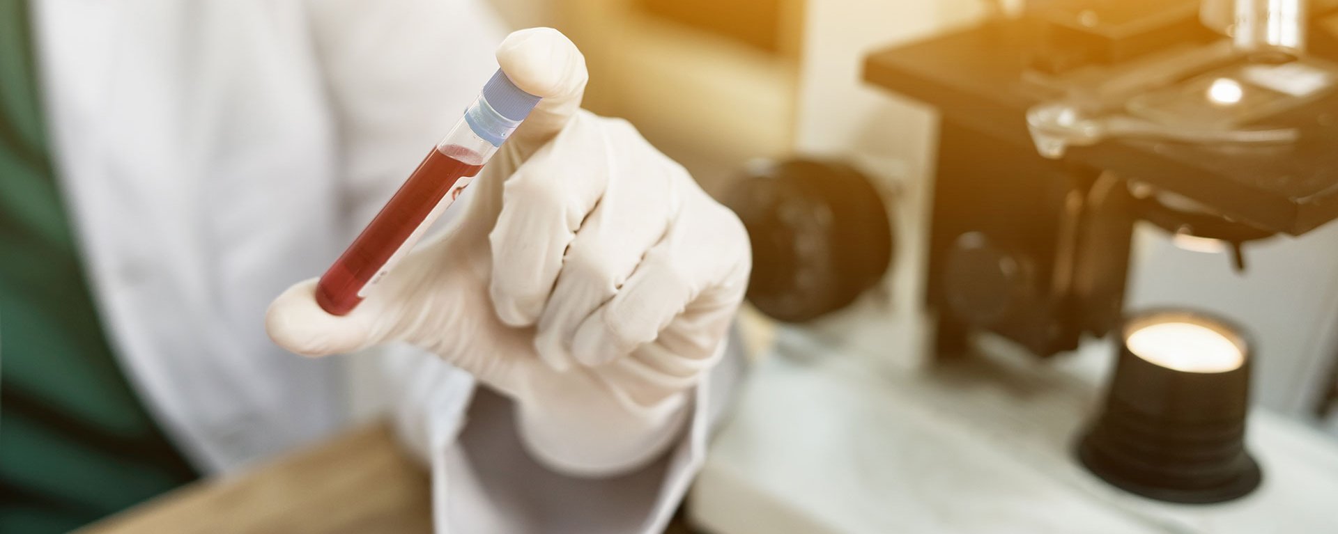 Ein Labortechniker macht einen Bluttest im Klinikverbund Allgäu. Im Hintergrund steht ein Mikroskop.